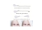 Yüz Kaş Göz Boyun Gerdirme Bantları ve Lastikleri (40 Adet)